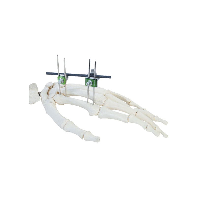 Phalanges of fingers & metacarpal bones frame (2-hole)